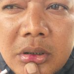 Korban penganiayaan