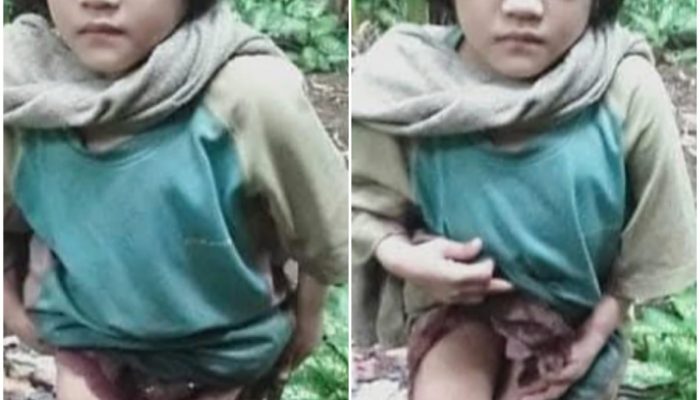 Kisah Pilu Anak 10 Tahun di Hilikara, Nias Selatan