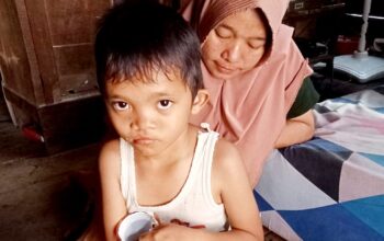 Bocah Disabilitas