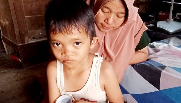 Bocah Disabilitas Asal Hutapuli Butuh Uluran Tangan Dermawan