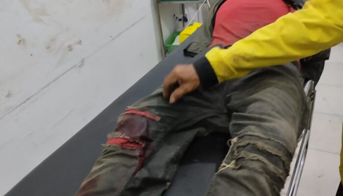 Tuntut Hak ke PT Barapala, Warga Diduga Diserang Oknum Sekuriti Menggunakan Panah dan Tombak