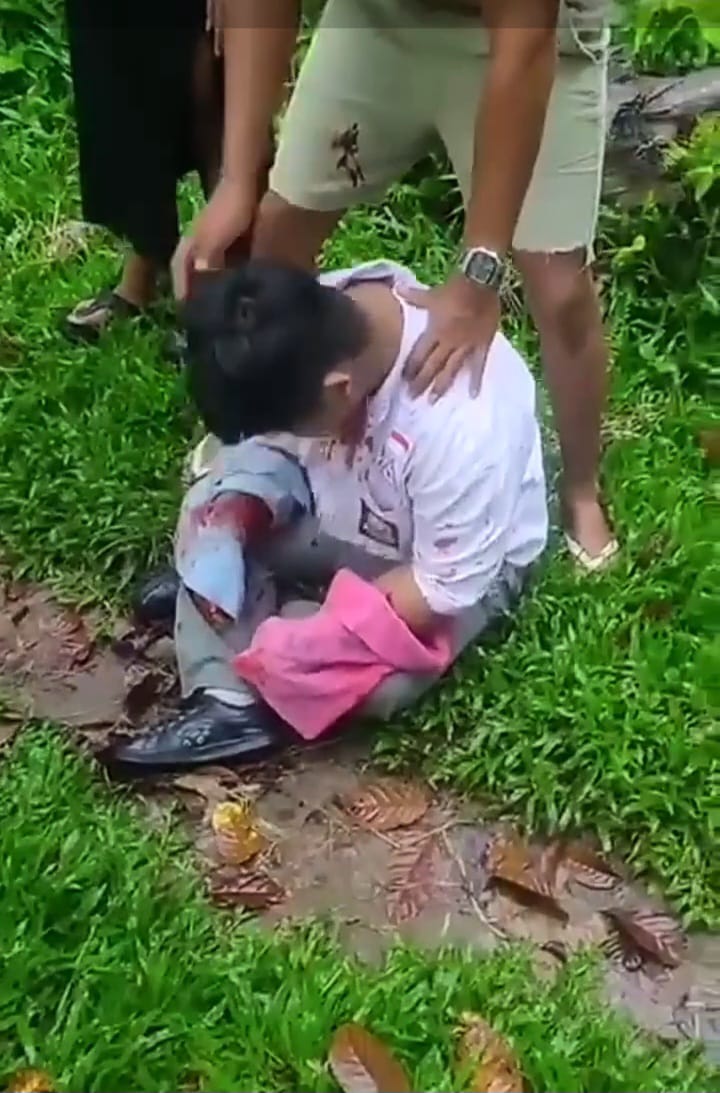 Remaja Korban Begal